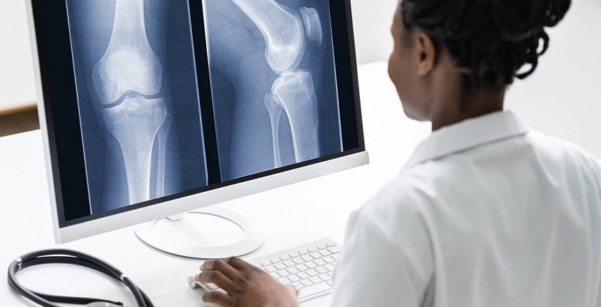a healthcare professional looking at a bone x-ray of a knee and recording medical coding documentation at a hospital